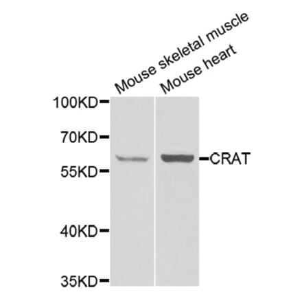 Anti-CRAT Antibody from Bioworld Technology (BS8160) - Antibodies.com