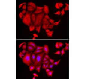 Anti-SLC26A2 Antibody from Bioworld Technology (BS8163) - Antibodies.com