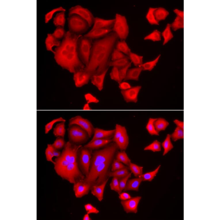 Anti-SLC26A2 Antibody from Bioworld Technology (BS8163) - Antibodies.com