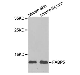 Anti-FABP5 Antibody from Bioworld Technology (BS8166) - Antibodies.com