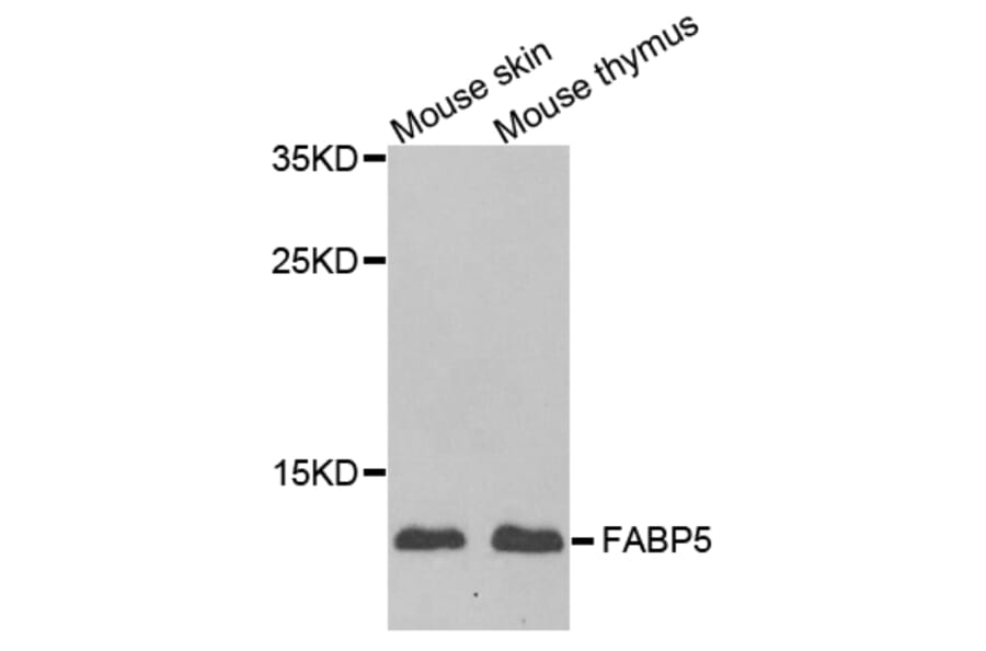 Anti-FABP5 Antibody from Bioworld Technology (BS8166) - Antibodies.com