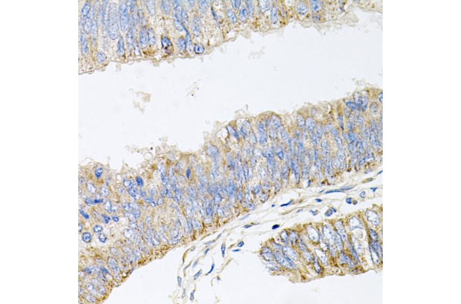 Anti-GP2 Antibody from Bioworld Technology (BS8169) - Antibodies.com