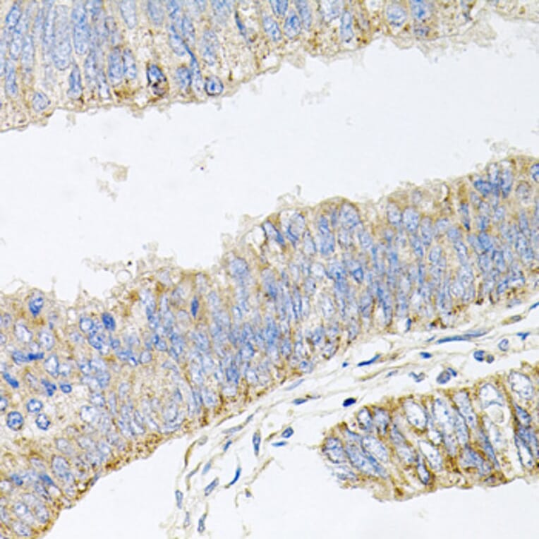 Anti-GP2 Antibody from Bioworld Technology (BS8169) - Antibodies.com