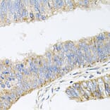 Anti-GP2 Antibody from Bioworld Technology (BS8169) - Antibodies.com