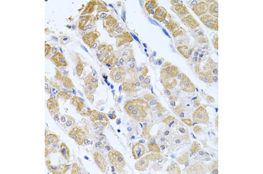 Anti-GP2 Antibody from Bioworld Technology (BS8169) - Antibodies.com