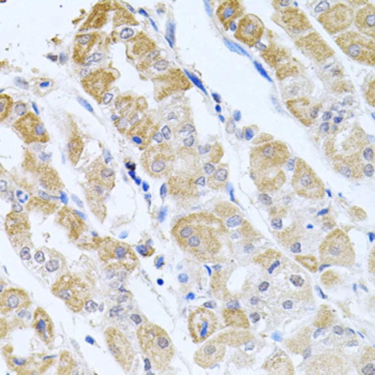 Anti-GP2 Antibody from Bioworld Technology (BS8169) - Antibodies.com