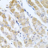 Anti-GP2 Antibody from Bioworld Technology (BS8169) - Antibodies.com