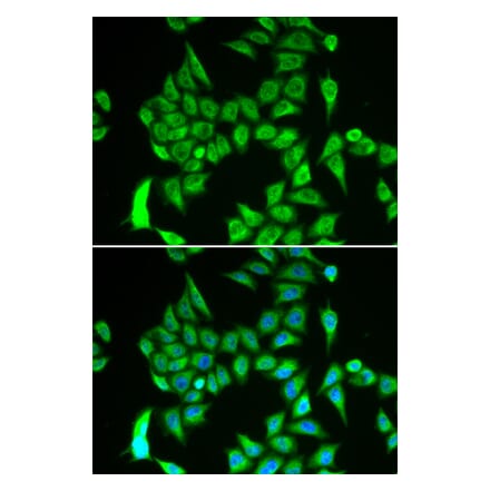 Anti-IREB2 Antibody from Bioworld Technology (BS8172) - Antibodies.com