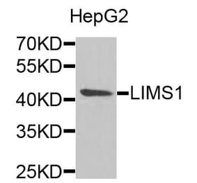 Anti-LIMS1 Antibody from Bioworld Technology (BS8174) - Antibodies.com