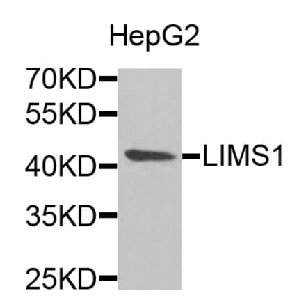 Anti-LIMS1 Antibody from Bioworld Technology (BS8174) - Antibodies.com