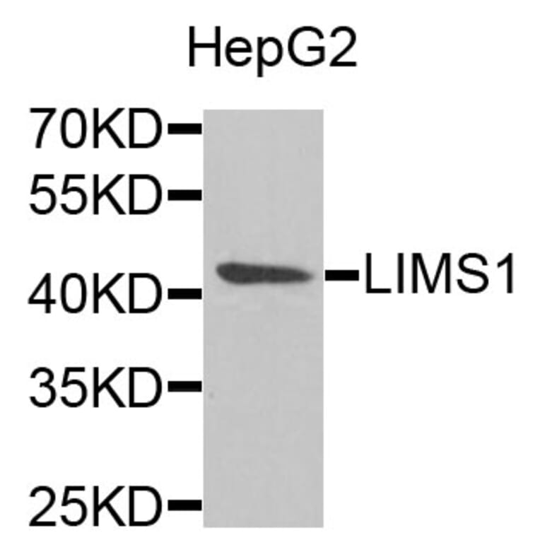 Anti-LIMS1 Antibody from Bioworld Technology (BS8174) - Antibodies.com