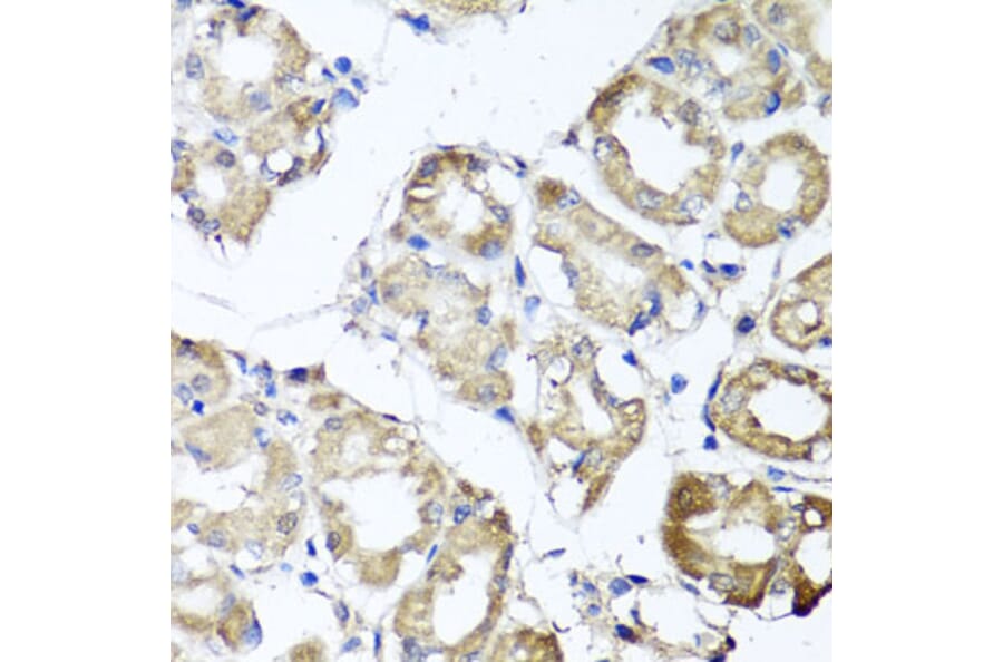 Anti-MGAT1 Antibody from Bioworld Technology (BS8176) - Antibodies.com