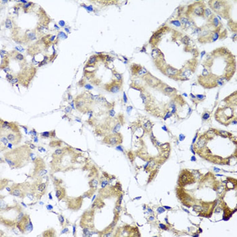 Anti-MGAT1 Antibody from Bioworld Technology (BS8176) - Antibodies.com