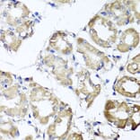 Anti-MGAT1 Antibody from Bioworld Technology (BS8176) - Antibodies.com