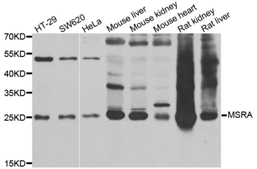 Anti-MSRA Antibody from Bioworld Technology (BS8178) - Antibodies.com