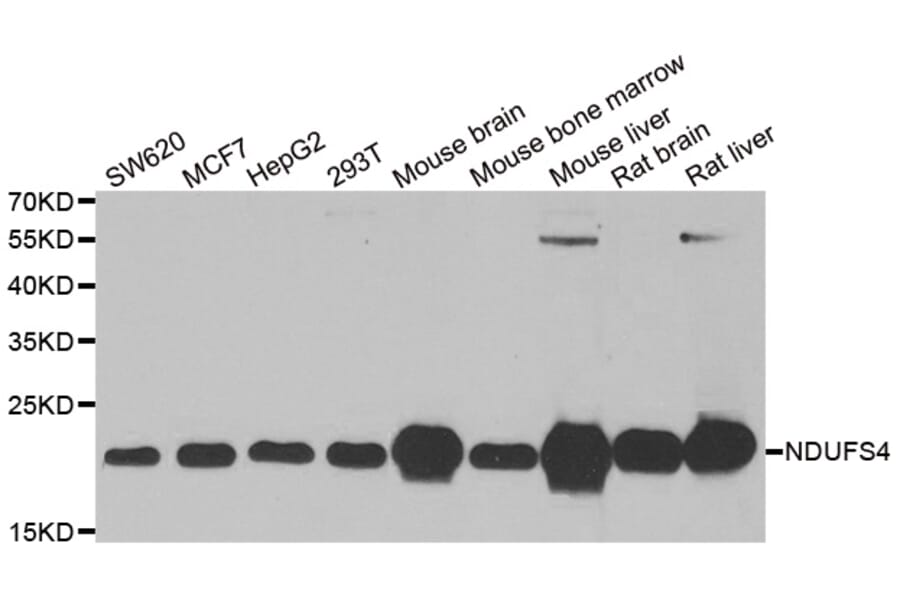 Anti-NDUFS4 Antibody from Bioworld Technology (BS8179) - Antibodies.com