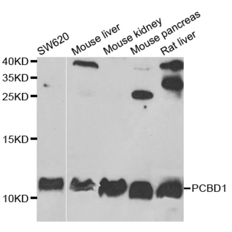 Anti-PCBD1 Antibody from Bioworld Technology (BS8181) - Antibodies.com