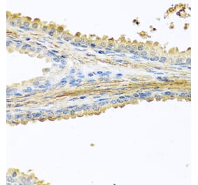 Anti-PIP Antibody from Bioworld Technology (BS8182) - Antibodies.com