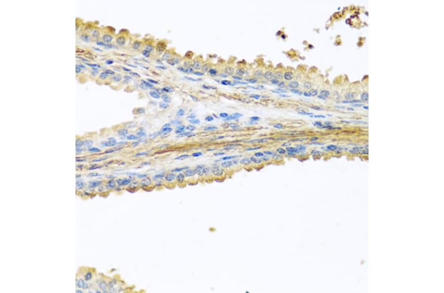 Anti-PIP Antibody from Bioworld Technology (BS8182) - Antibodies.com
