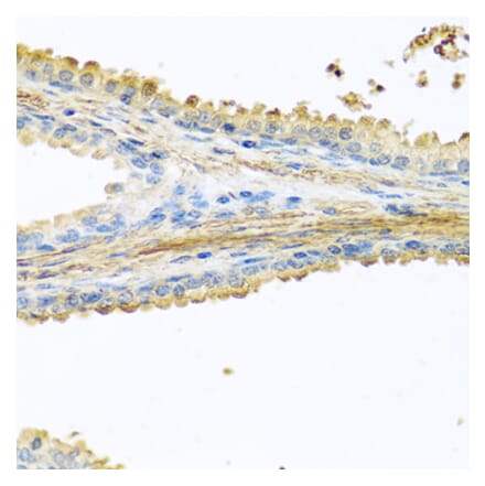 Anti-PIP Antibody from Bioworld Technology (BS8182) - Antibodies.com