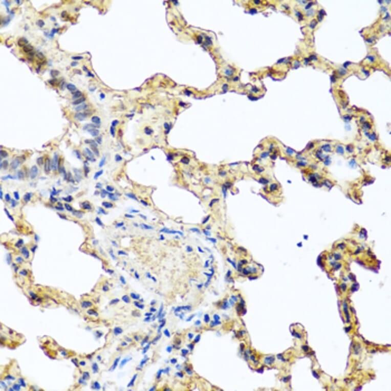 Anti-PIP Antibody from Bioworld Technology (BS8182) - Antibodies.com