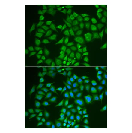 Anti-PNOC Antibody from Bioworld Technology (BS8183) - Antibodies.com
