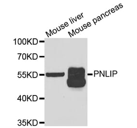 Anti-PNLIP Antibody from Bioworld Technology (BS8184) - Antibodies.com