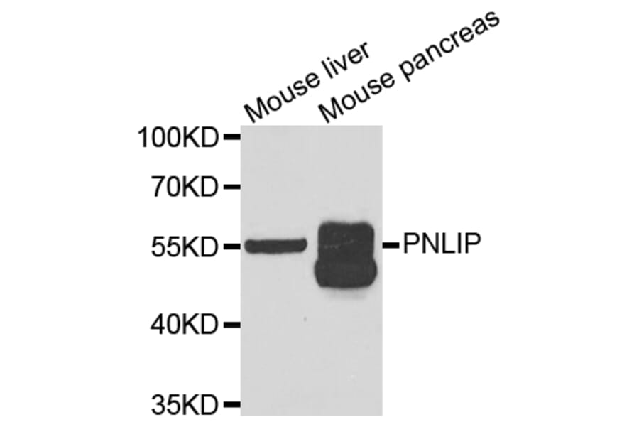 Anti-PNLIP Antibody from Bioworld Technology (BS8184) - Antibodies.com