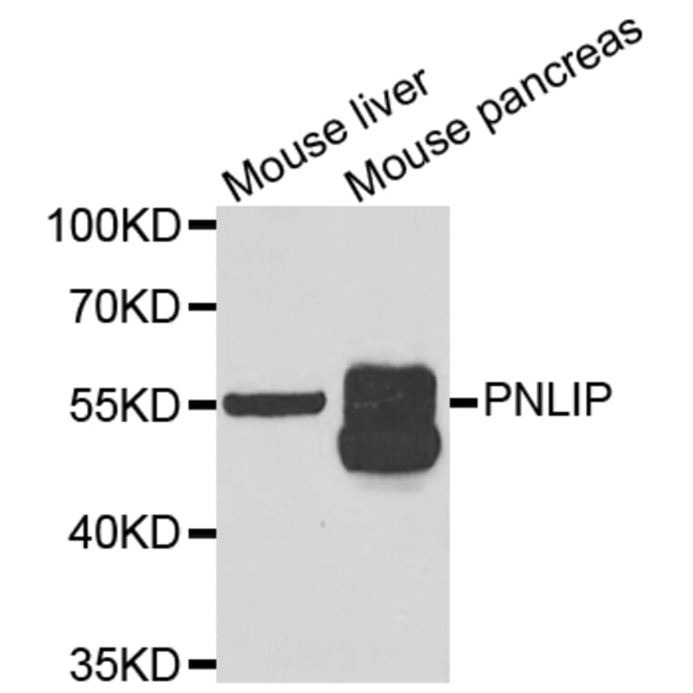 Anti-PNLIP Antibody from Bioworld Technology (BS8184) - Antibodies.com