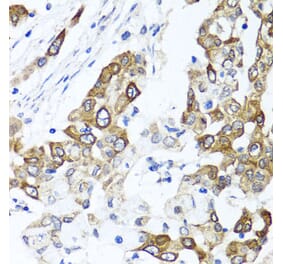 Anti-PPOX Antibody from Bioworld Technology (BS8185) - Antibodies.com