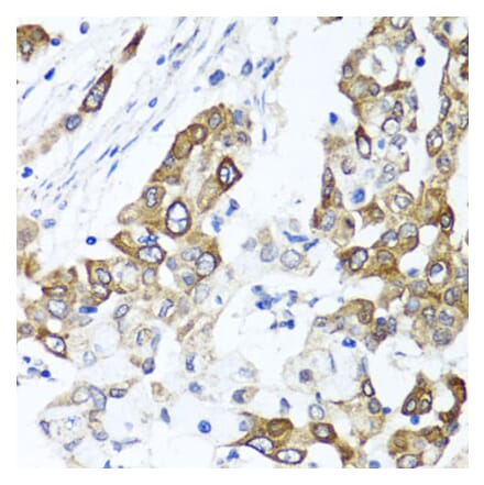 Anti-PPOX Antibody from Bioworld Technology (BS8185) - Antibodies.com