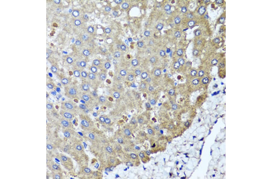 Anti-PPOX Antibody from Bioworld Technology (BS8185) - Antibodies.com