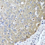 Anti-PPOX Antibody from Bioworld Technology (BS8185) - Antibodies.com