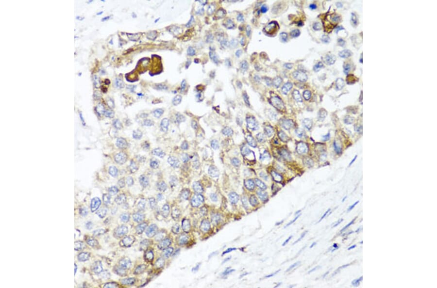 Anti-PPOX Antibody from Bioworld Technology (BS8185) - Antibodies.com