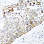 Anti-PPOX Antibody from Bioworld Technology (BS8185) - Antibodies.com