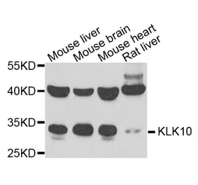 Anti-KLK10 Antibody from Bioworld Technology (BS8186) - Antibodies.com