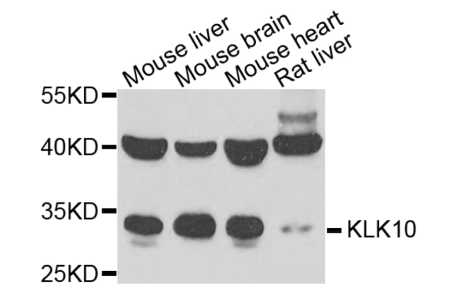 Anti-KLK10 Antibody from Bioworld Technology (BS8186) - Antibodies.com