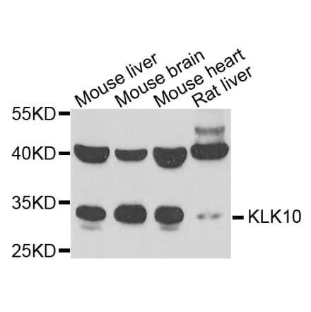 Anti-KLK10 Antibody from Bioworld Technology (BS8186) - Antibodies.com