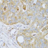 Anti-PSG1 Antibody from Bioworld Technology (BS8187) - Antibodies.com