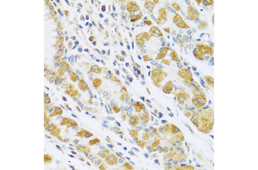 Anti-PSG1 Antibody from Bioworld Technology (BS8187) - Antibodies.com