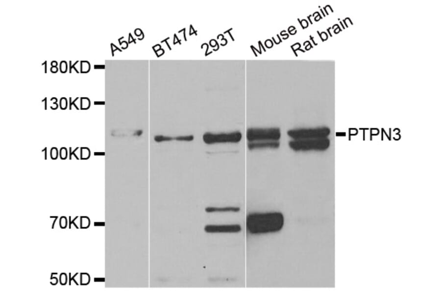 Anti-PTPN3 Antibody from Bioworld Technology (BS8188) - Antibodies.com