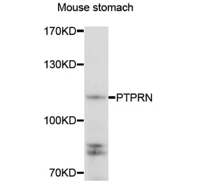 Anti-PTPRN Antibody from Bioworld Technology (BS8189) - Antibodies.com