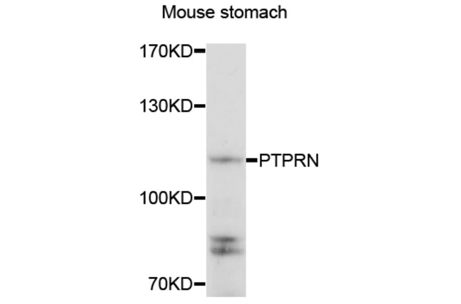 Anti-PTPRN Antibody from Bioworld Technology (BS8189) - Antibodies.com