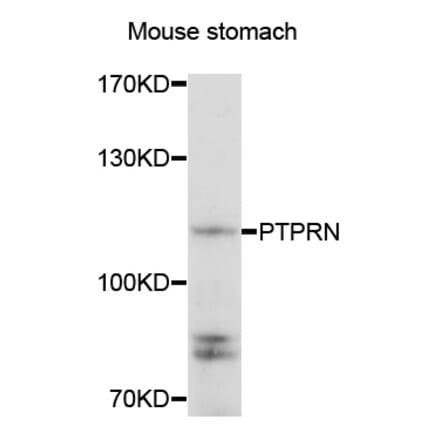Anti-PTPRN Antibody from Bioworld Technology (BS8189) - Antibodies.com