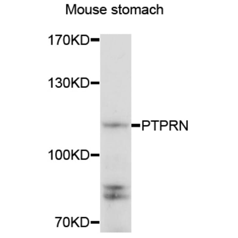 Anti-PTPRN Antibody from Bioworld Technology (BS8189) - Antibodies.com