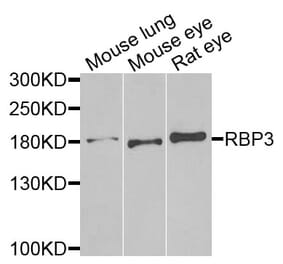 Anti-RBP3 Antibody from Bioworld Technology (BS8191) - Antibodies.com