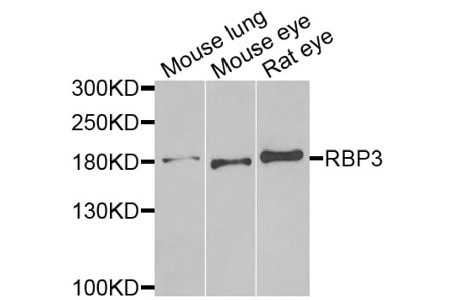 Anti-RBP3 Antibody from Bioworld Technology (BS8191) - Antibodies.com