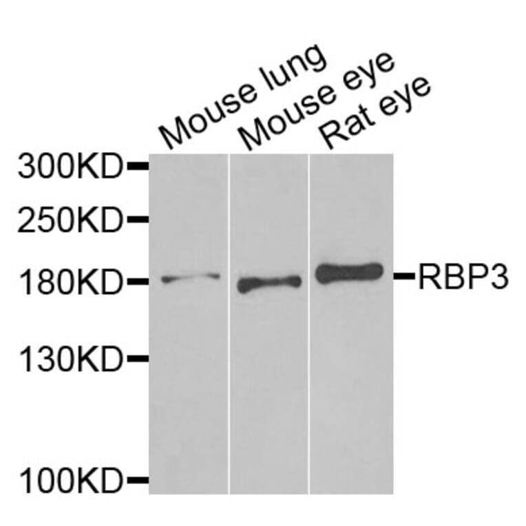 Anti-RBP3 Antibody from Bioworld Technology (BS8191) - Antibodies.com