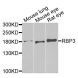 Anti-RBP3 Antibody from Bioworld Technology (BS8191) - Antibodies.com