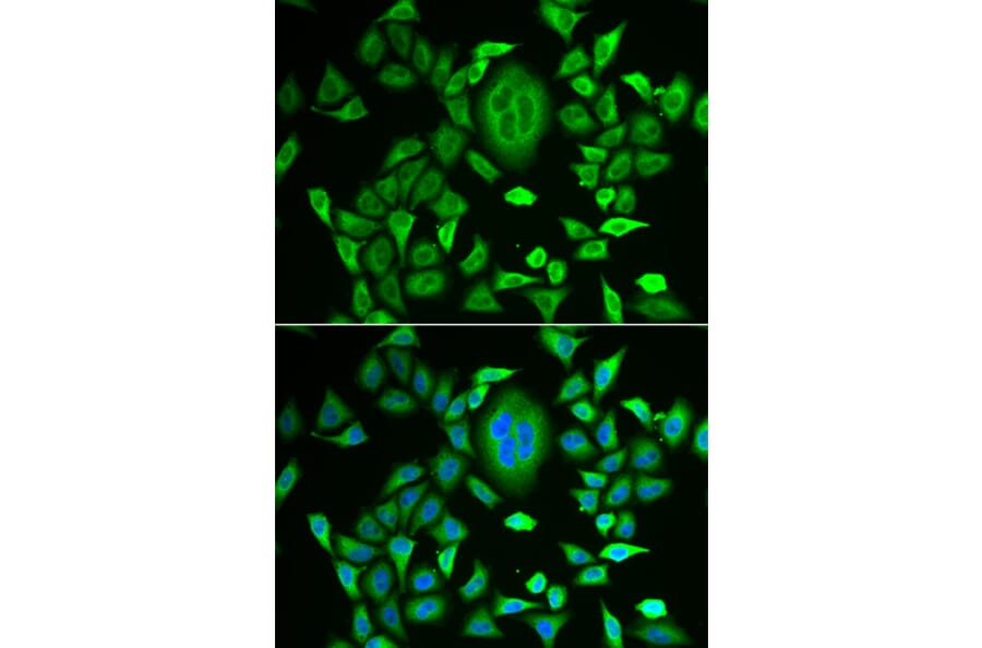 Anti-RBP3 Antibody from Bioworld Technology (BS8191) - Antibodies.com
